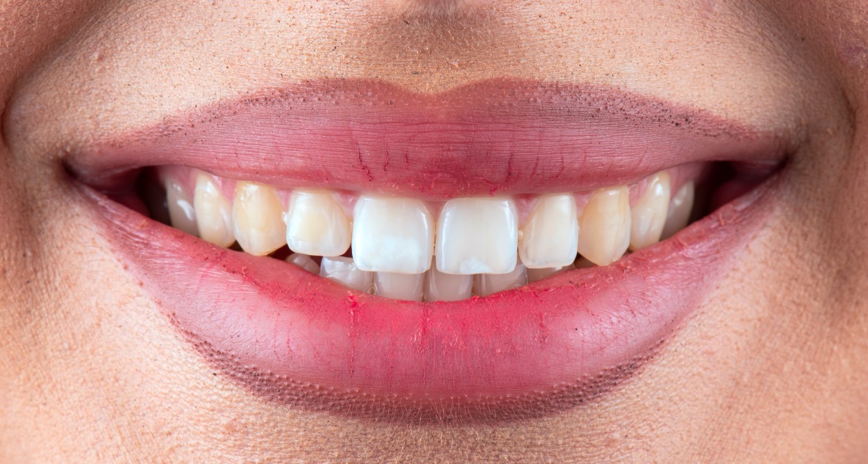 The House of Dentistry - After The House of Dentistry - After